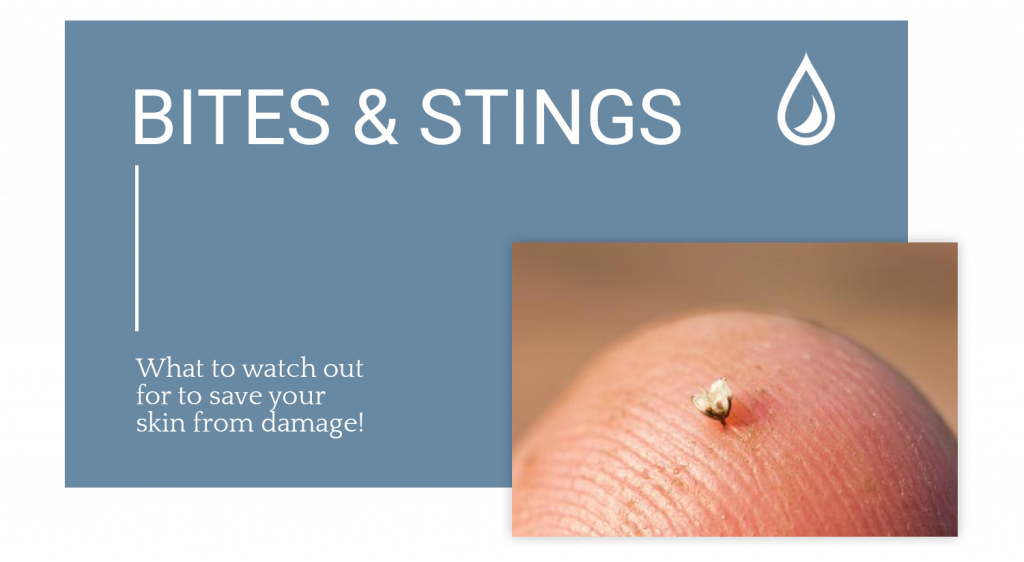 Bites and Stings The Dermatology Specialists
