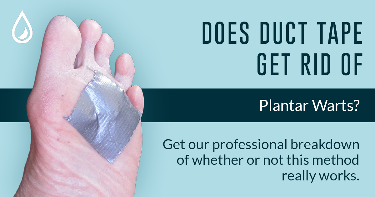 Plantar Warts And Duct Tape What You Should Know - How To Get Rid Of A Wart Diy