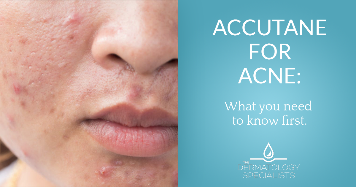 accutane for oily skin