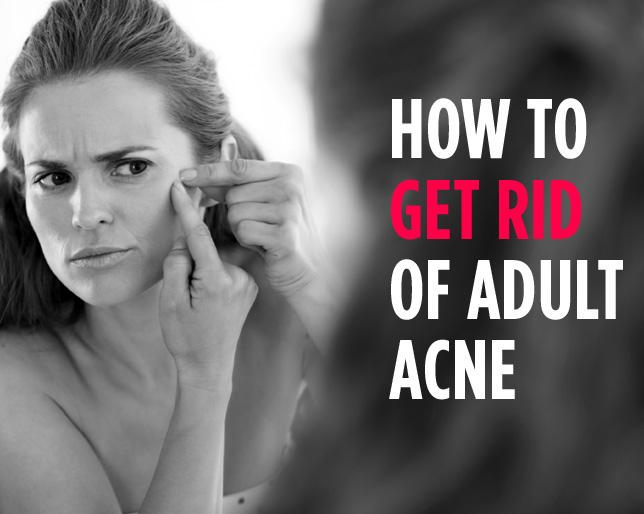 adult acne tips
