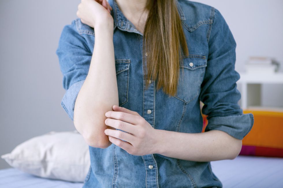 woman scratching elbow