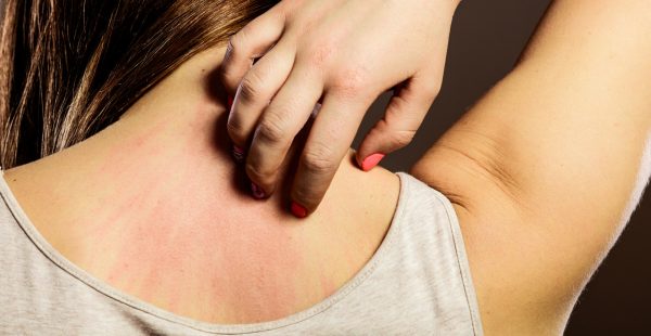 woman scratching back of neck