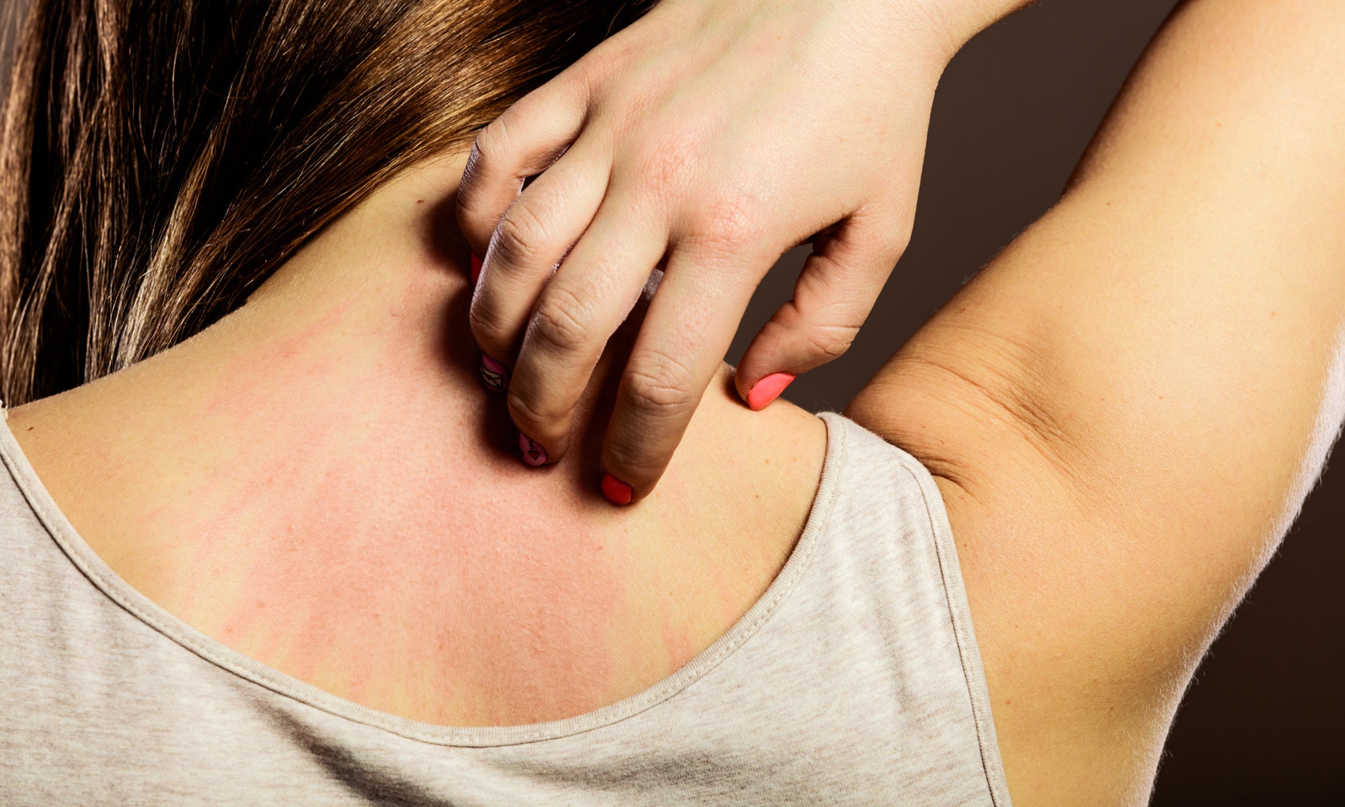 woman scratching back of neck