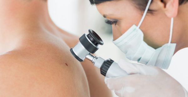 skin cancer specialists